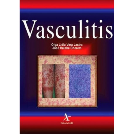Vasculitis - Envío Gratuito