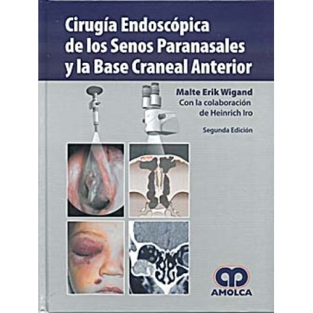 Cirugía endoscópica de los senos paranasales y la base craneal anterior - Envío Gratuito