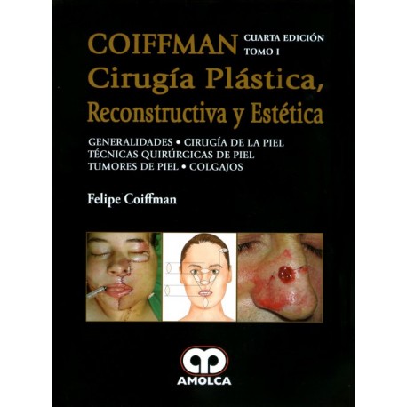COIFFMAN I: Generalidades, Cirugía de Piel, Técnicas Quirúrgicas de Piel, Tumores de Piel, Colgajos Amolca - Envío Gratuito