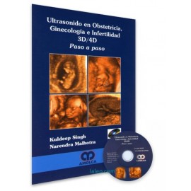 Ultrasonido en Obstetricia, Ginecología e Infertilidad 3D/4D. Paso a Paso + CD - Envío Gratuito