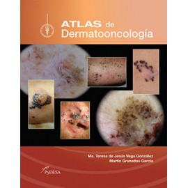 Atlas de Dermatooncología - Envío Gratuito