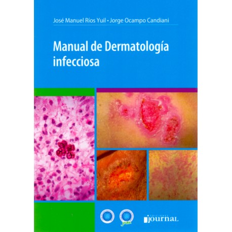 Manual de Dermatología infecciosa - Envío Gratuito