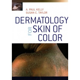 Dermatology for Skin of Color - Envío Gratuito